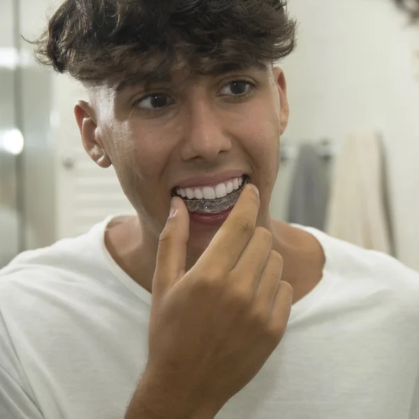 teenage male applying clear aligners