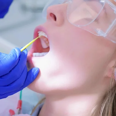 fluoride-treatment dentist applying fluoride treatment