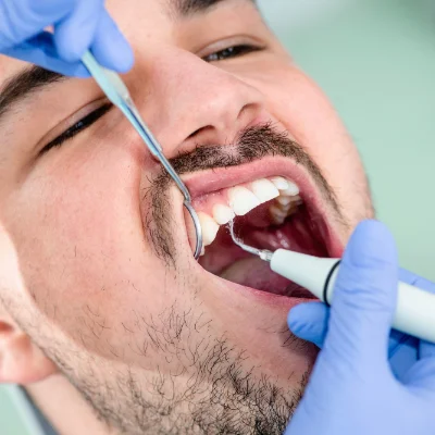 hygieniest-teeth-cleaning Male patient getting Plaque removal