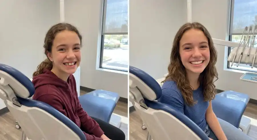 before and after photos of a teenage girl in dental office. Before photo shows girl with uneven teeth. After photo shows girl with straight teeth.