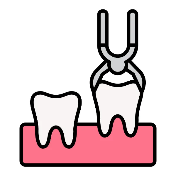 Illustration of a tooth being extracted with dental forceps.